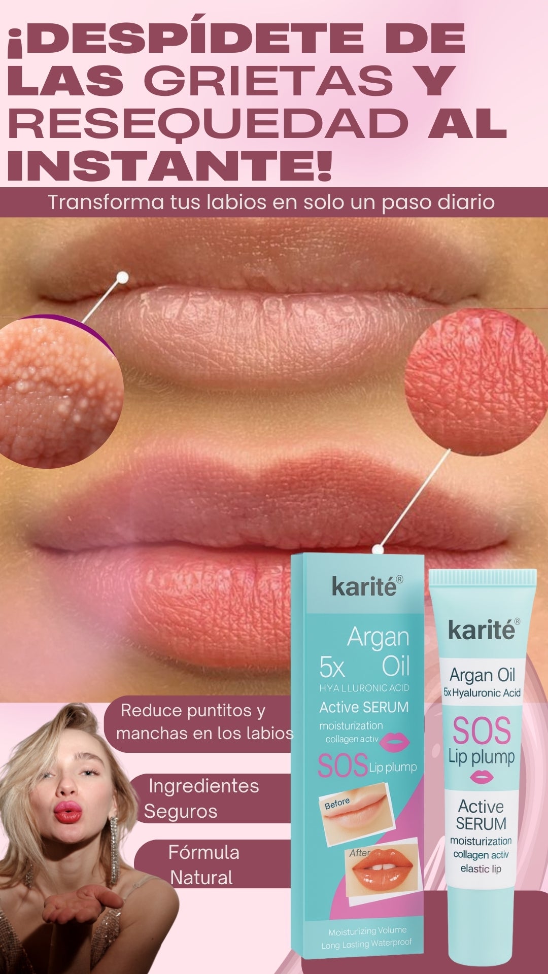 💋 Fordyce Clean Pro – Deshazte de las imperfecciones labiales 💋